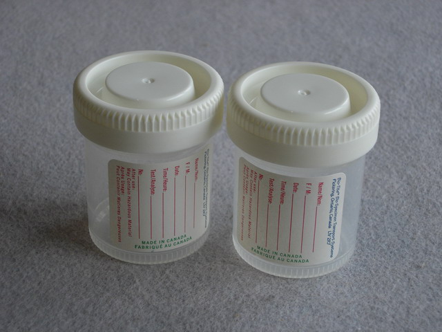 Cup, Urine (Non-Sterile) - 3 oz.