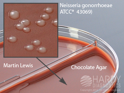 Chocolate/Martin Lewis With Lincomycin