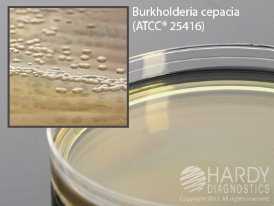 Pseudomonas Agar P