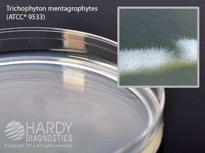 Potato Dextrose Agar With TA
