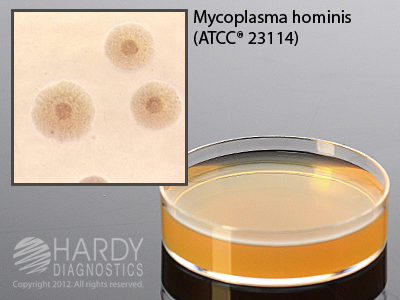 SP4 Agar with Glucose