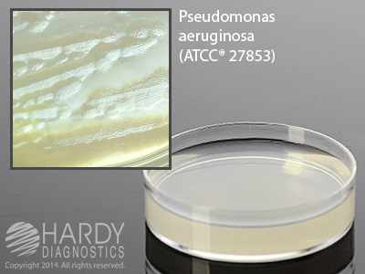 Skim Milk Agar