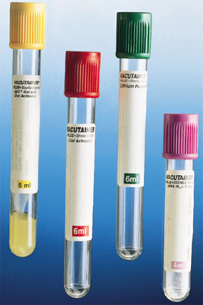 Cell Preparation (Blue/Black ) Top Tube (CPT) - 8 mL.
