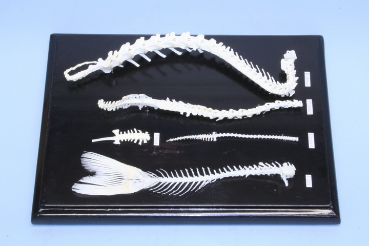 Spinal Column Comparison