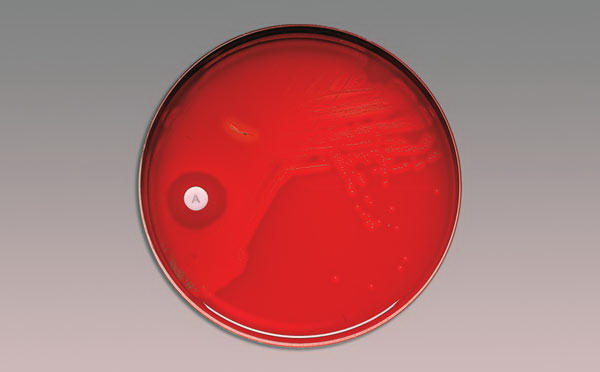 BD BBL Brand BD Taxo Disks and Strips, Group A streptococci