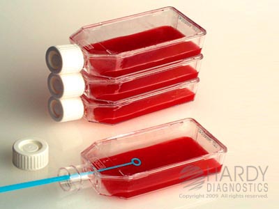 BHI Agar With Blood