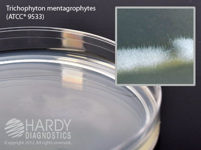 Potato Dextrose Agar