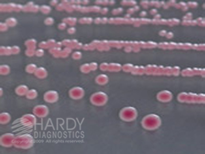HardyCHROM E. coli O157