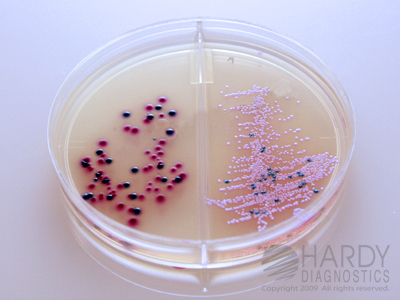 HardyCHROM Urine Biplate (HUrBi)