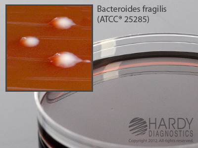 LKV Agar