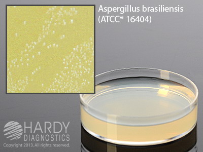 Orange Serum Agar