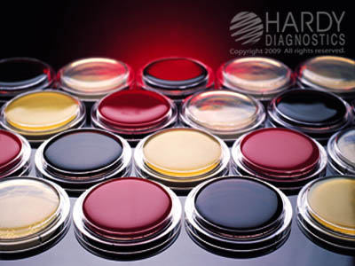 R2A Agar