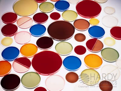 TSA Blood Agar, 5% <B>(MINIMUM ORDER: 10 packs)