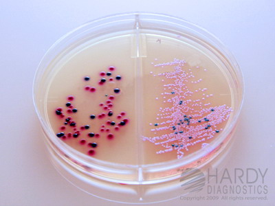 HardyCHROM Urine Biplate (HUrBi)