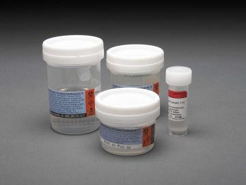 Prefilled Neutral Buffered Formalin - 20 mL